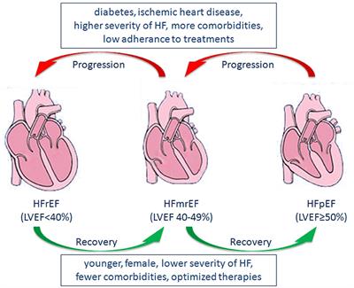 Heart Failure With Mid-range Ejection Fraction: A Distinctive Subtype or a Transitional Stage?